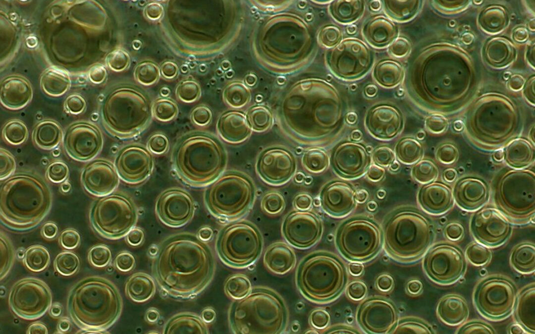 All about Phase Contrast Microscopes