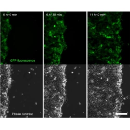 keratinocytes in time series