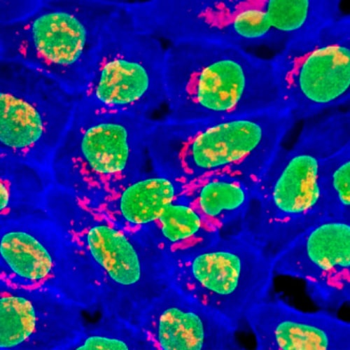 keratinocytes in time series