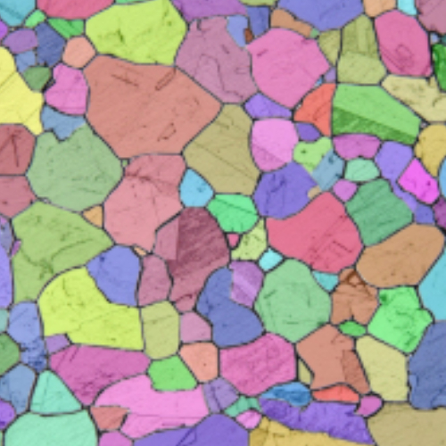 hippocampal neurons