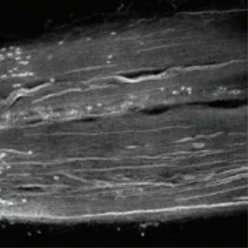 keratinocytes in time series