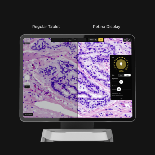 Echo Rebel Retina Display