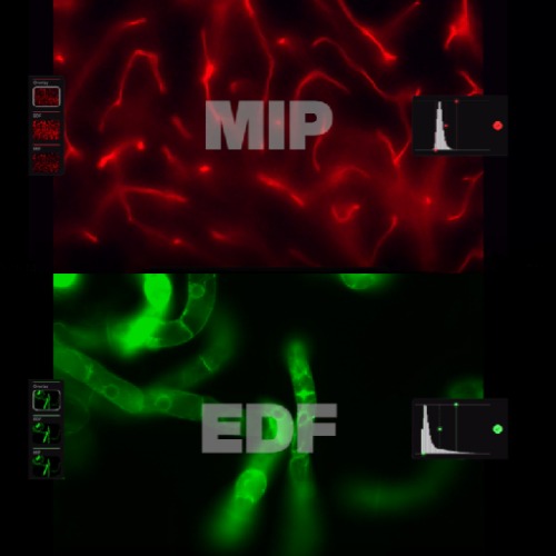 Echo Revolve MIP & EDF Echo Revolve MIP & EDF